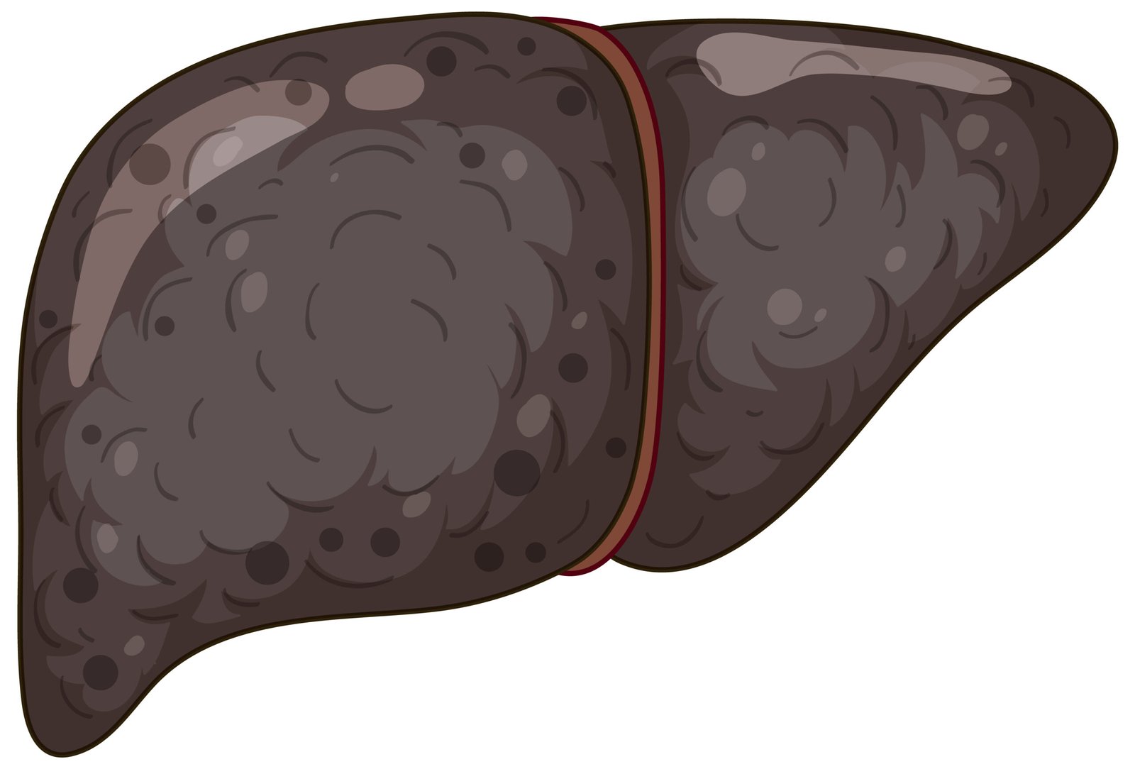 Hepatic Tumors