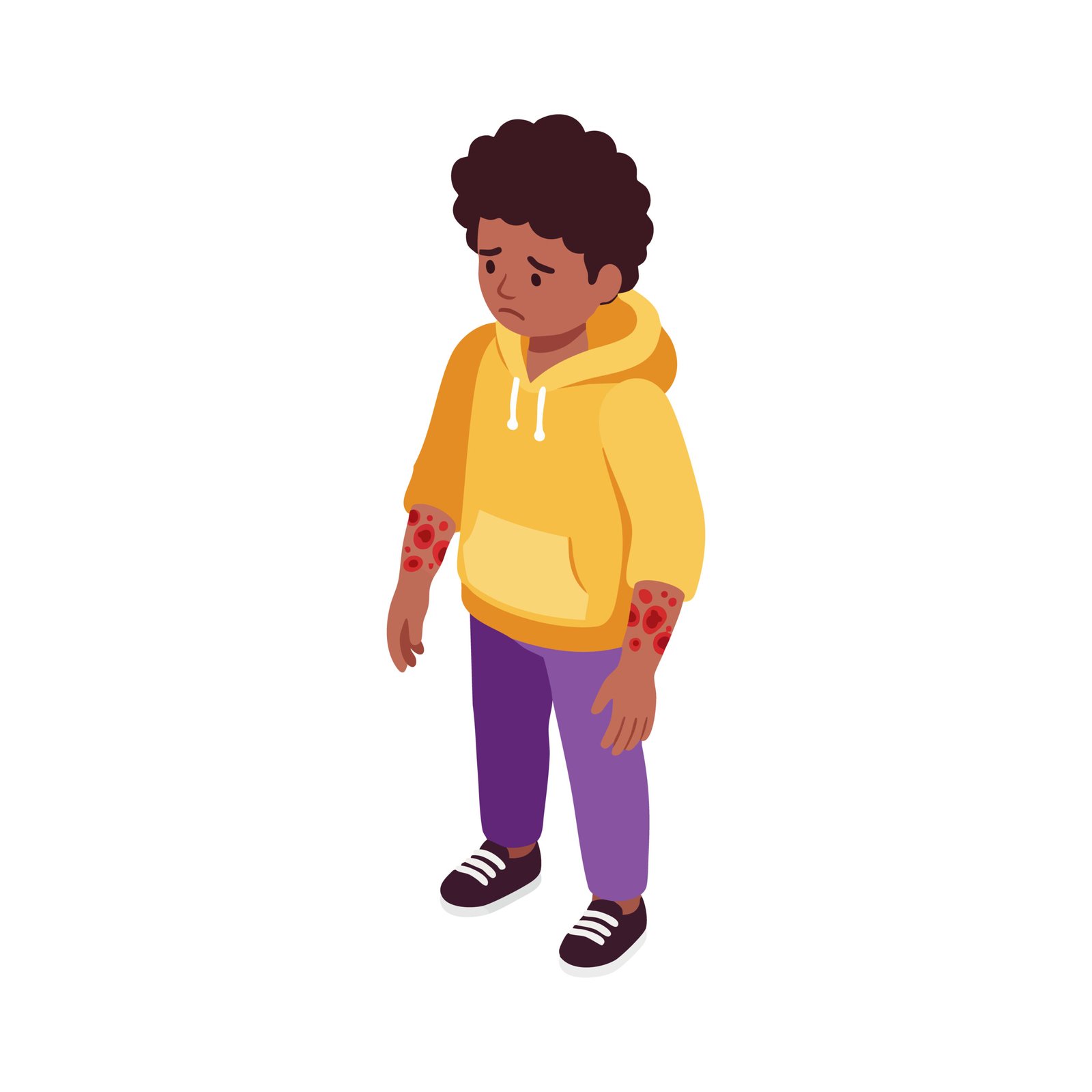 Boy with skin rash on arms wearing yellow hoodie and purple pants vector illustration of child with skin condition